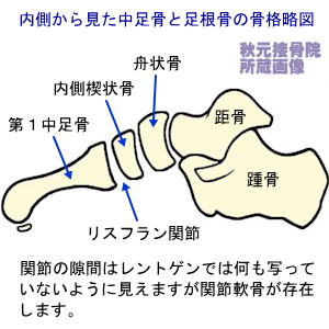 内側から見た中足骨と足根骨の略図