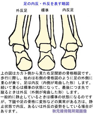 足の内反・外反を表す略図