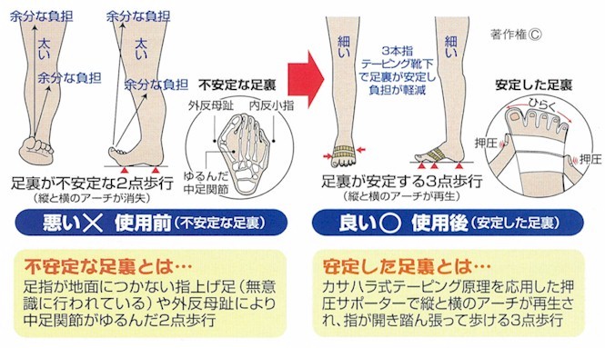 足裏姿勢の解説